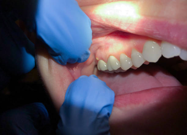 Best Emergency Orthodontic Services in North Oaks, MN